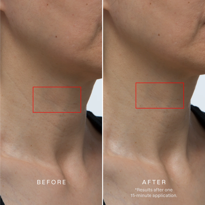 Collagen Hydrogel Neck Mask